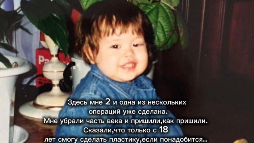 Җырчы Айгизә Галимова тумыштан килгән патологиясе турында сөйли