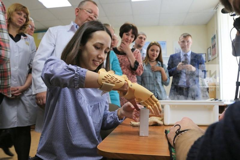 Потерявшей руку студентке из Челнов установили уникальный протез
